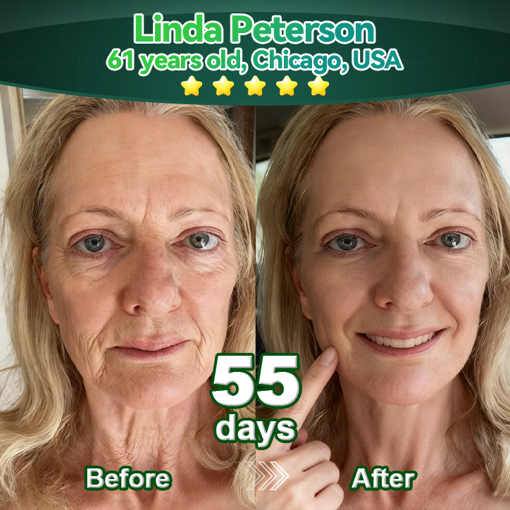 Once Daily, Visible Changes in 7 Days✅𝑇𝑟𝑖𝑙𝑢𝑚𝑖𝑎® 𝖢𝗁𝗅𝗈𝗋𝗈𝗉𝗁𝗒𝗅𝗅 & 𝑆𝑡𝑒𝑚 𝐶𝑒𝑙𝑙 𝖻𝗈𝖽𝗒 𝗋𝖾𝗇𝖾𝗐𝖺𝗅 𝗌𝖾𝗋𝗎𝗆（𝐿𝑖𝑓𝑡 & 𝐹𝑖𝑟𝑚 𝑆𝑎𝑔𝑔𝑖𝑛𝑔 𝑆𝑘𝑖𝑛 & 𝑅𝑒𝑑𝑢𝑐𝑒 𝑊𝑟𝑖𝑛𝑘𝑙𝑒 𝐹𝑜𝑟𝑚𝑎𝑡𝑖𝑜𝑛🐦‍🔥