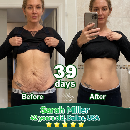 Once Daily, Visible Changes in 7 Days✅𝑇𝑟𝑖𝑙𝑢𝑚𝑖𝑎® 𝖢𝗁𝗅𝗈𝗋𝗈𝗉𝗁𝗒𝗅𝗅 & 𝑆𝑡𝑒𝑚 𝐶𝑒𝑙𝑙 𝖻𝗈𝖽𝗒 𝗋𝖾𝗇𝖾𝗐𝖺𝗅 𝗌𝖾𝗋𝗎𝗆（𝐿𝑖𝑓𝑡 & 𝐹𝑖𝑟𝑚 𝑆𝑎𝑔𝑔𝑖𝑛𝑔 𝑆𝑘𝑖𝑛 & 𝑅𝑒𝑑𝑢𝑐𝑒 𝑊𝑟𝑖𝑛𝑘𝑙𝑒 𝐹𝑜𝑟𝑚𝑎𝑡𝑖𝑜𝑛🐦‍🔥
