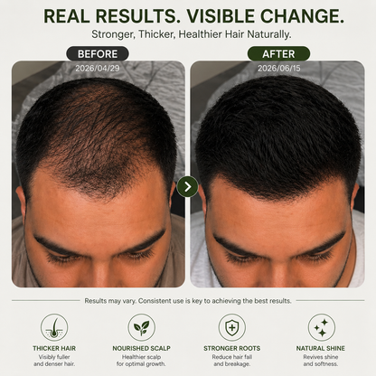 Pryxo® Batana Oil – For Noticeably Thinning Hair & Excessive Shedding