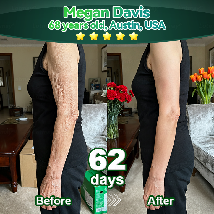Once Daily, Visible Changes in 7 Days✅𝑇𝑟𝑖𝑙𝑢𝑚𝑖𝑎® 𝖢𝗁𝗅𝗈𝗋𝗈𝗉𝗁𝗒𝗅𝗅 & 𝑆𝑡𝑒𝑚 𝐶𝑒𝑙𝑙 𝖻𝗈𝖽𝗒 𝗋𝖾𝗇𝖾𝗐𝖺𝗅 𝗌𝖾𝗋𝗎𝗆（𝐿𝑖𝑓𝑡 & 𝐹𝑖𝑟𝑚 𝑆𝑎𝑔𝑔𝑖𝑛𝑔 𝑆𝑘𝑖𝑛 & 𝑅𝑒𝑑𝑢𝑐𝑒 𝑊𝑟𝑖𝑛𝑘𝑙𝑒 𝐹𝑜𝑟𝑚𝑎𝑡𝑖𝑜𝑛🐦‍🔥