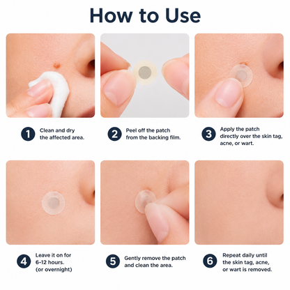 ✨Limited-Time Sale Ends Soon | Lumivo® 2-in-1 Microneedle Hydrocolloid Patches for Moles, Acne, Warts & Skin Tags