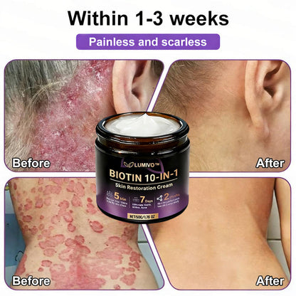 Made and Shipped from USA ✨LUMIVO™  Biotin 10-in-1 Skin Restoration Cream 🍀