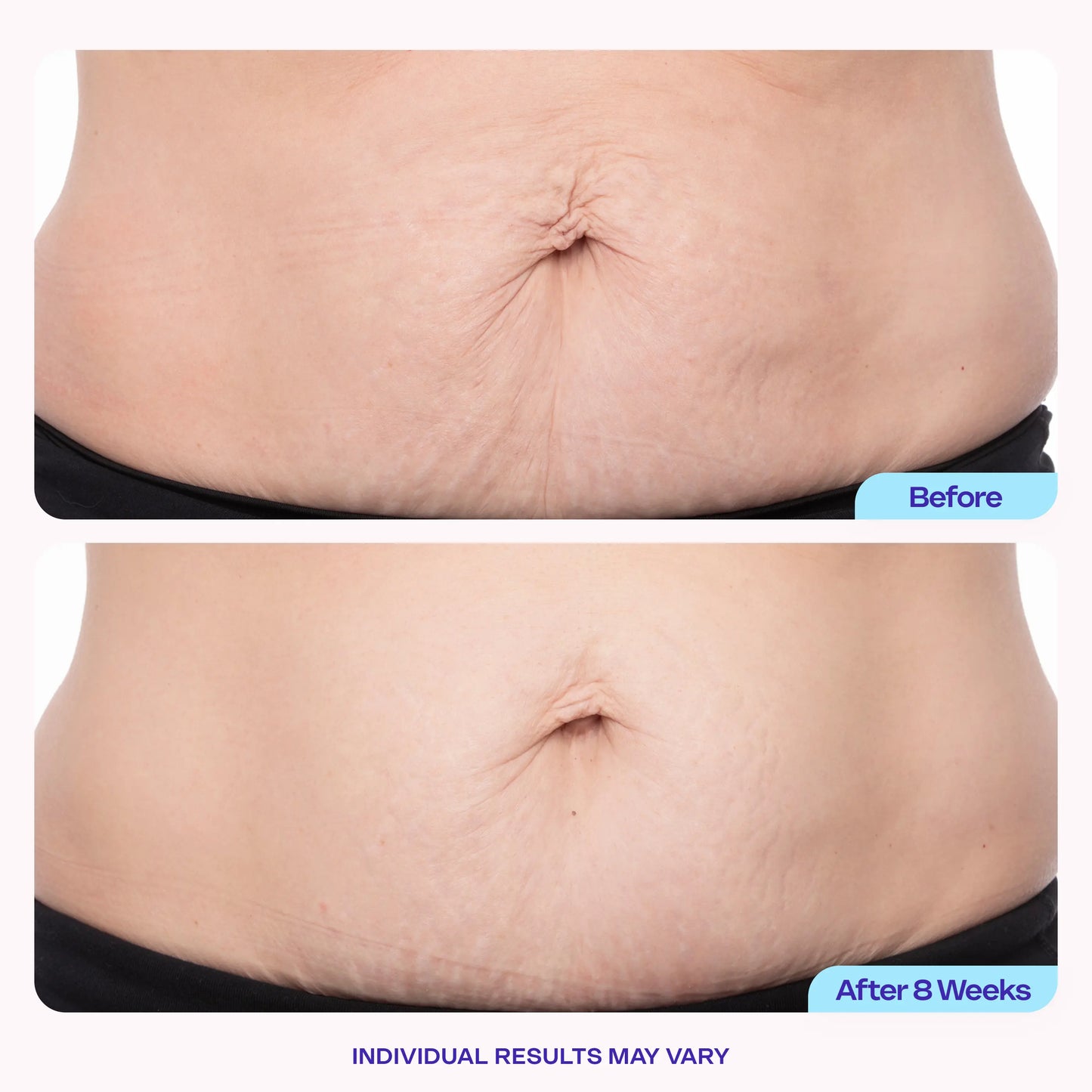 LUMIVO™ Tighten & Smooth Belly Firming Cream