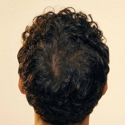 🎃Pumpkin Seed Regrowth Oil — Naturally Supports Thicker, Fuller Hair Growth✨💪